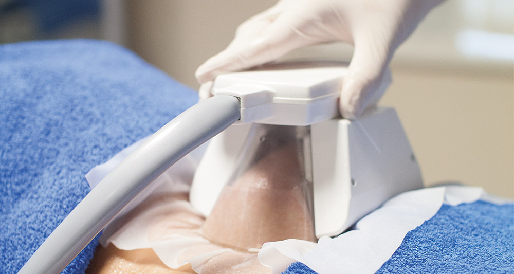 How Fat Freezing and HIFU Work Together? 2 Multiple Areas in One Session HIFU and Fat Freezing Hatfield