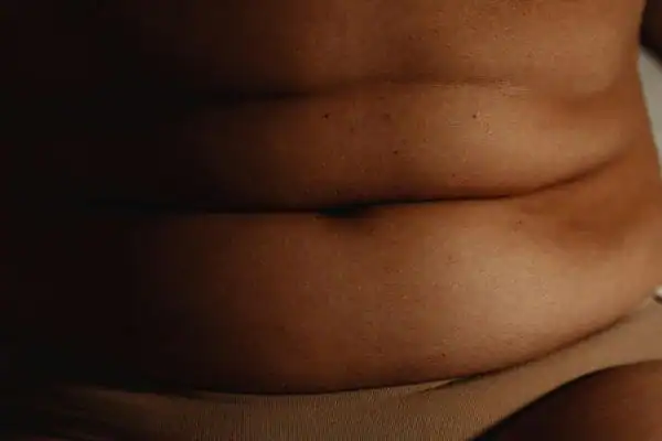 The Hidden Connection: How Stress Shapes Your Fitness and Body Composition 3 image of what stress can do on the stomach area and how Lipo 360 Hatfield can help to change your body shape.