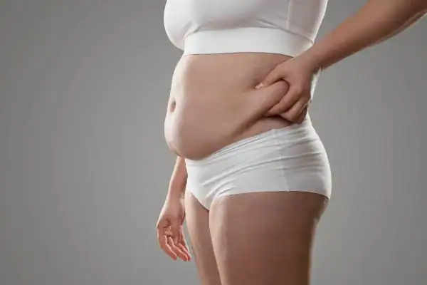 Image of stress belly Hatfield How Lipo 360 can help manage your symptoms